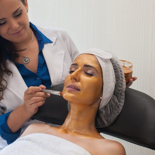 peeling quimico